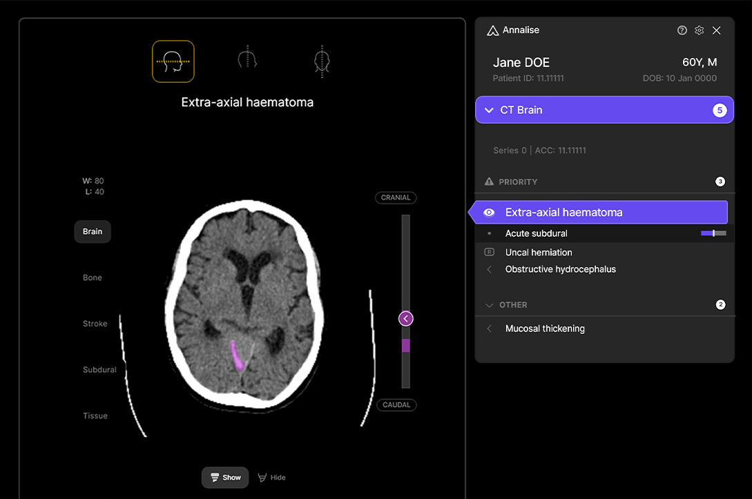 An image of a medical scan.